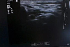 В поликлинику Калининского района поставили новый аппарат УЗИ